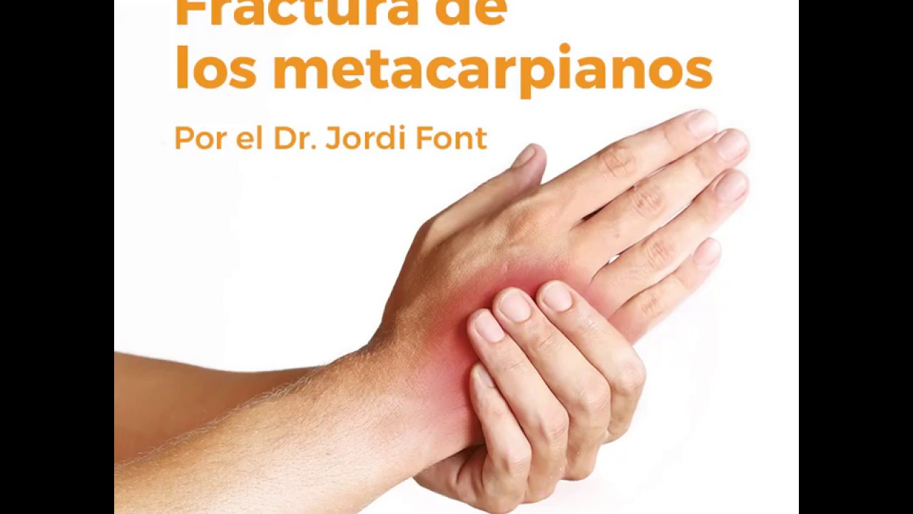 cuanto tarda en curar fractura metacarpiano