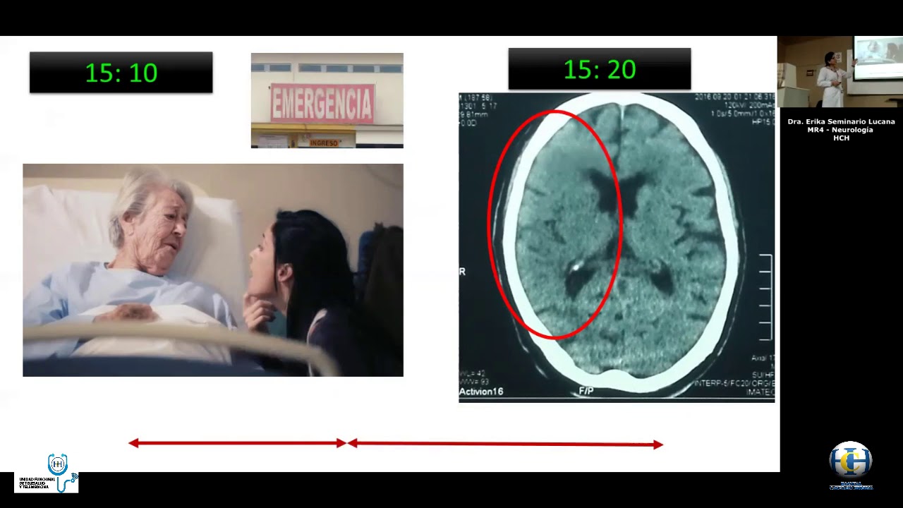 cuidados de enfermeria en pacientes con hemiplejia