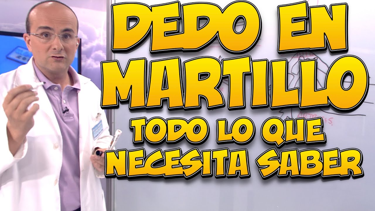 dedo de martillo pie tratamiento natural