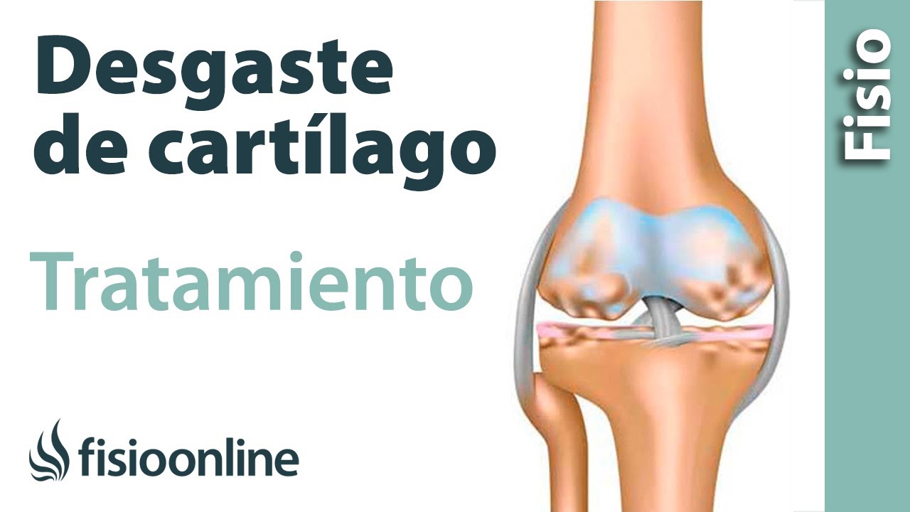 desgaste del cartilago articular de la rodilla