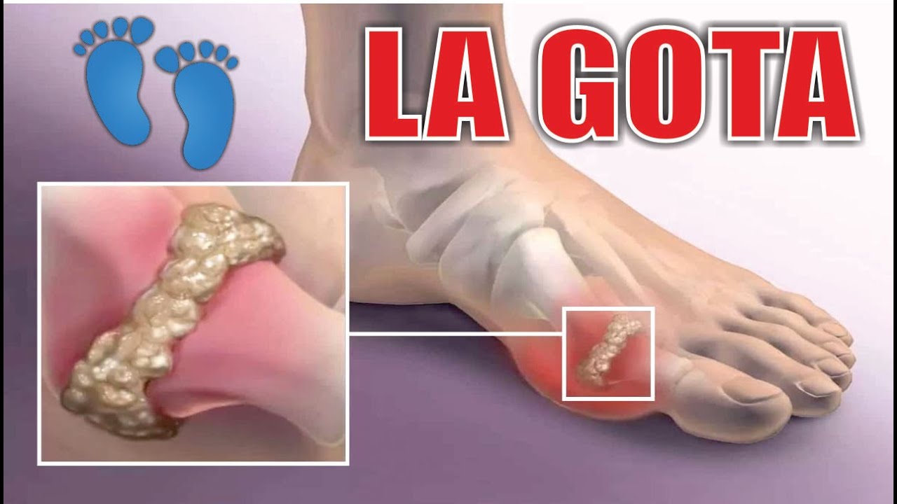 dolor en el dedo gordo del pie por golpe