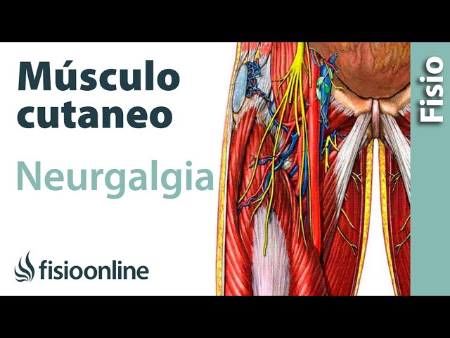 dolor y ardor en el muslo izquierdo