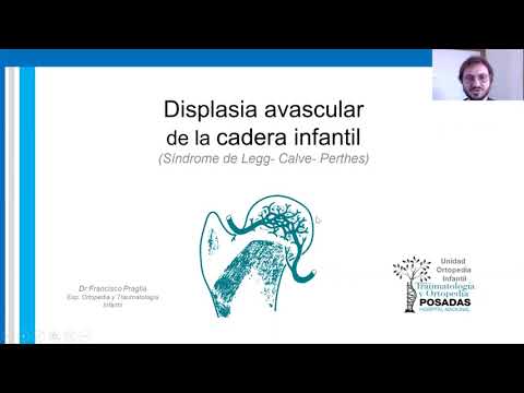 enfermedad de perthes en niños operacion