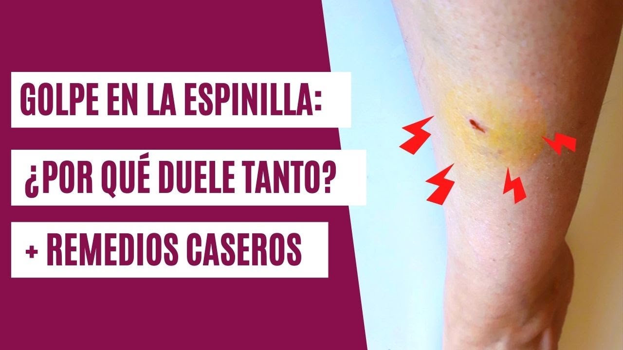 fisura en la tibia por golpe