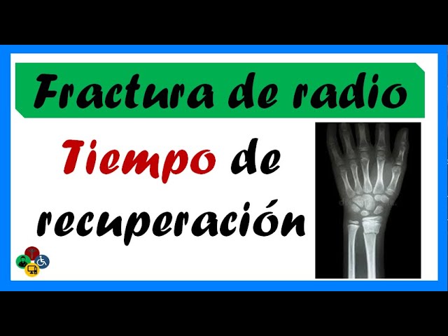 fractura cabeza de radio tiempo de baja laboral