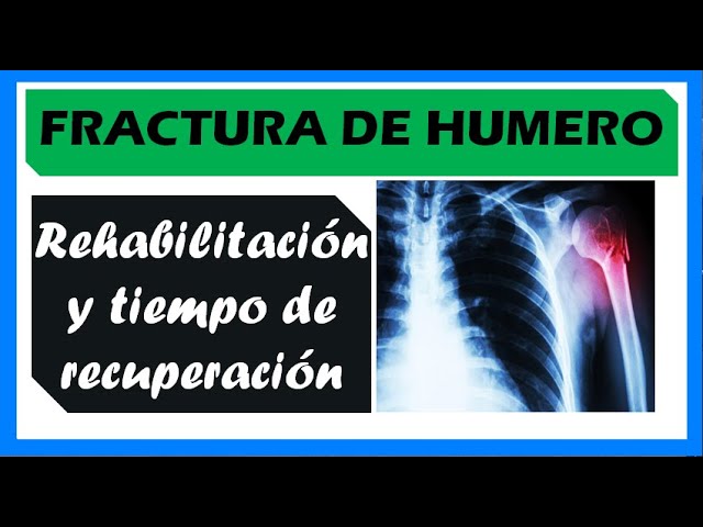 fractura de humero proximal tiempo de recuperacion