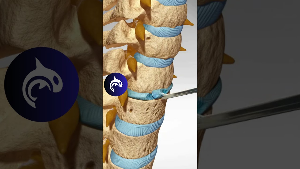 hendidura cervical de la linea media