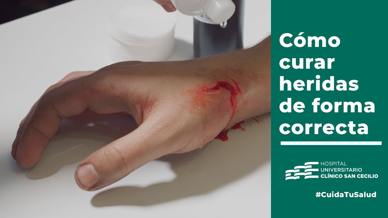 herida en palma de la mano