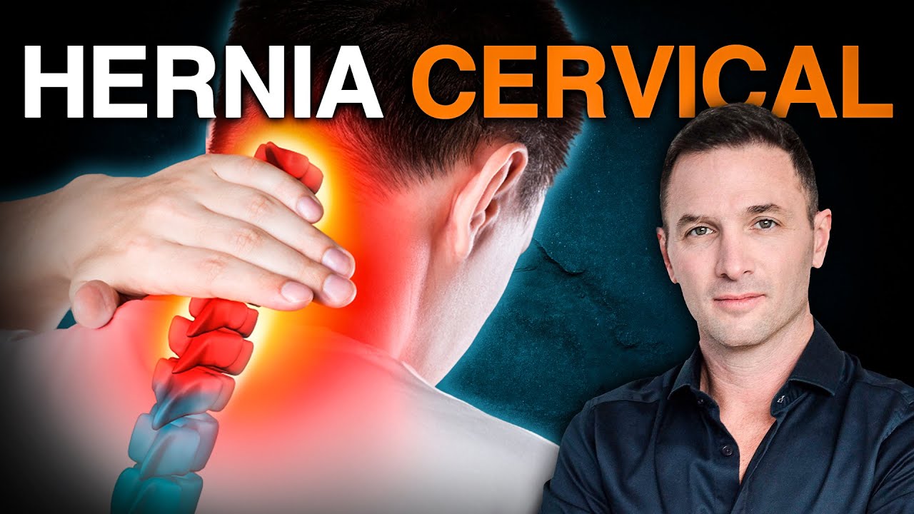 hernia cervical sintomas dolor de cabeza