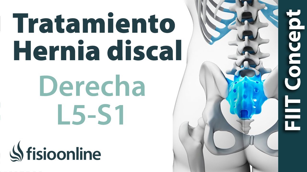 hernia discal l5 s1 sintomas tratamiento