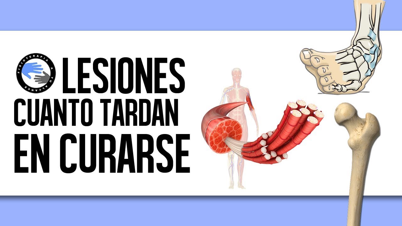 lesion de lisfranc tiempo de recuperacion