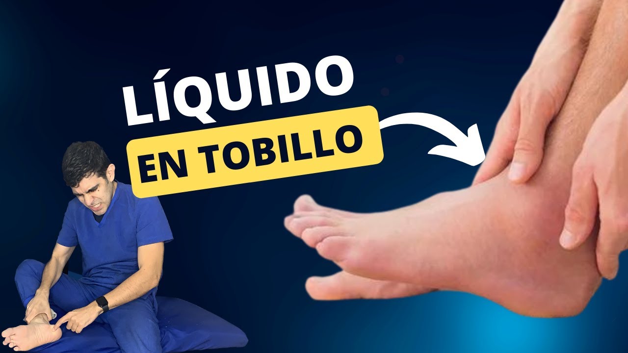 liquido en la articulacion del tobillo