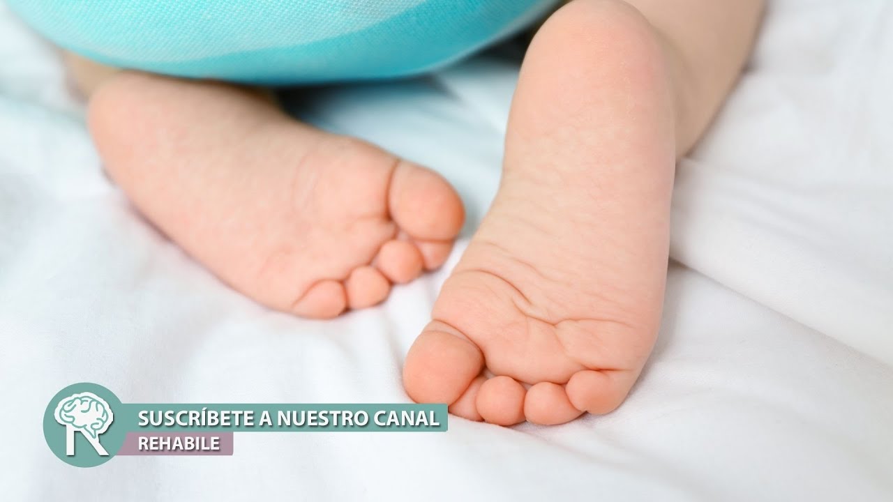 mi bebe arrastra un pie al caminar