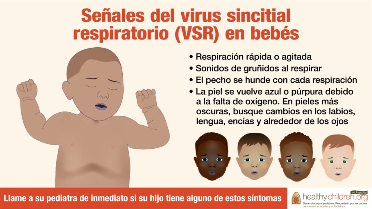 mi bebe respira como si tuviera flema