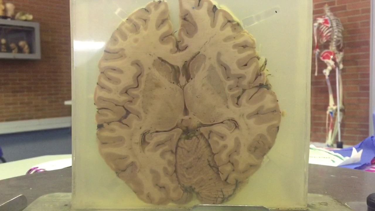 partes del encefalo humano corte transversal