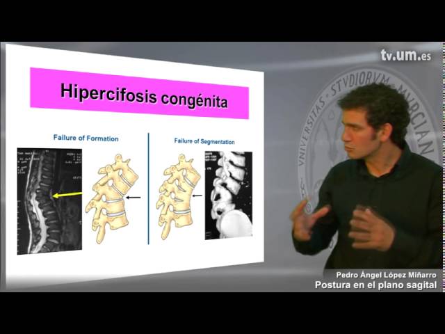 plano sagital de la columna vertebral
