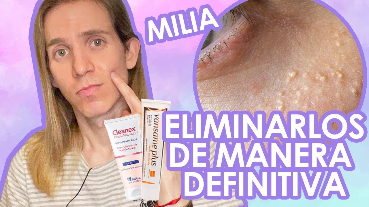 puntos de grasa en los ojos