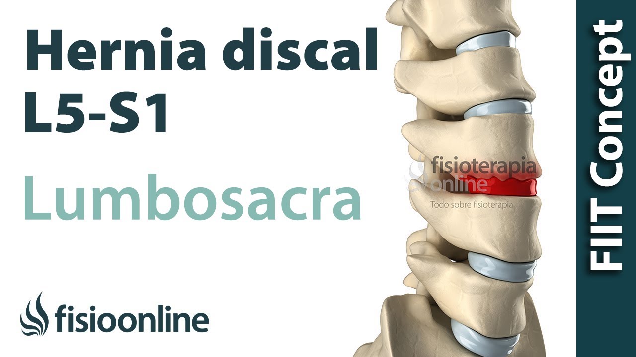 que es l5 en la columna