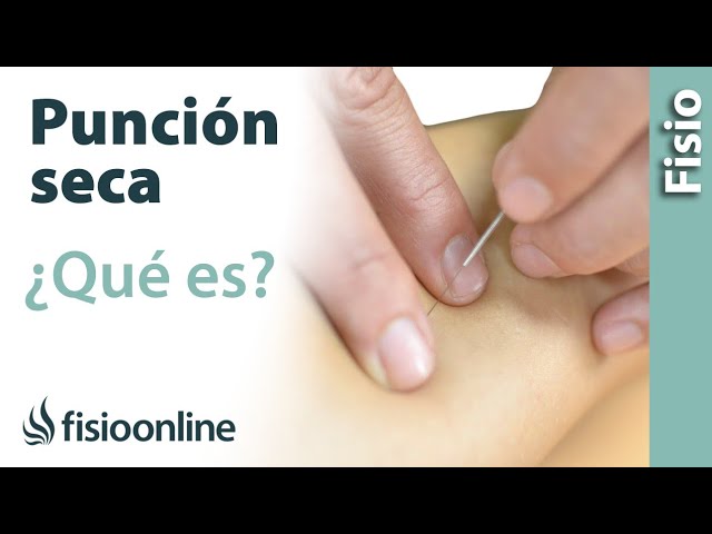 que es la puncion seca en fisioterapia