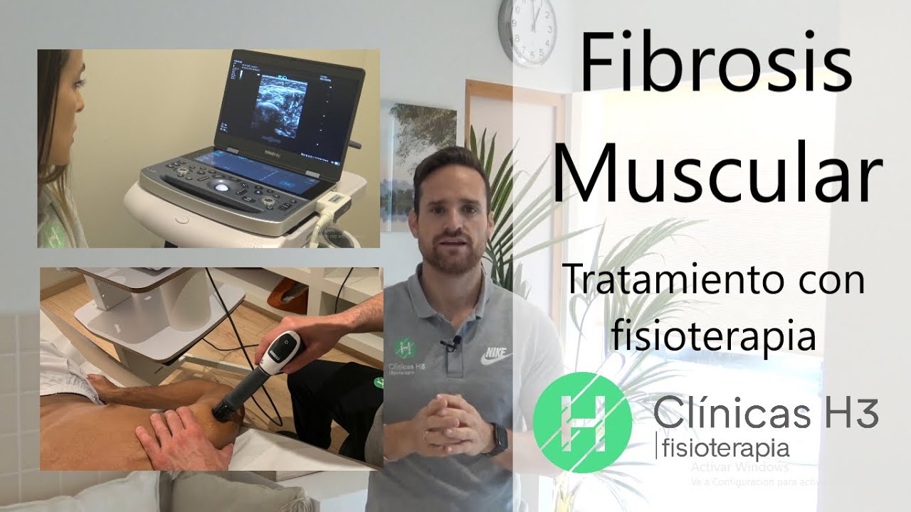 que especialista trata la fibrosis muscular