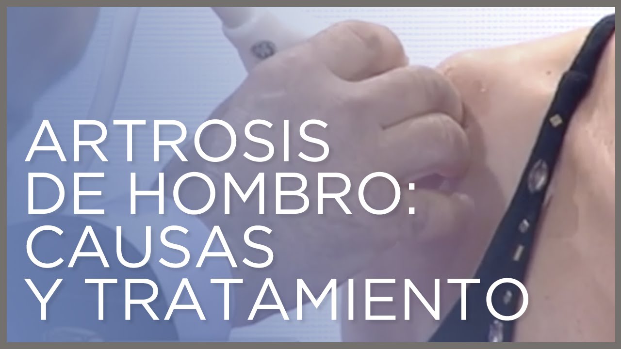 que tomar para la artrosis de hombro
