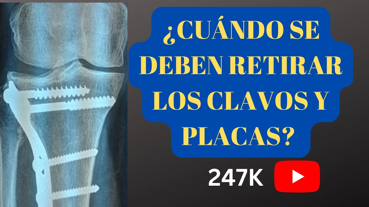 recuperación después de retirada de osteosíntesis