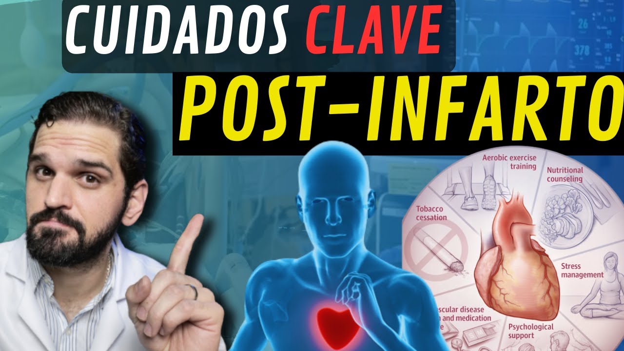 rehabilitacion despues de un infarto cardiaco