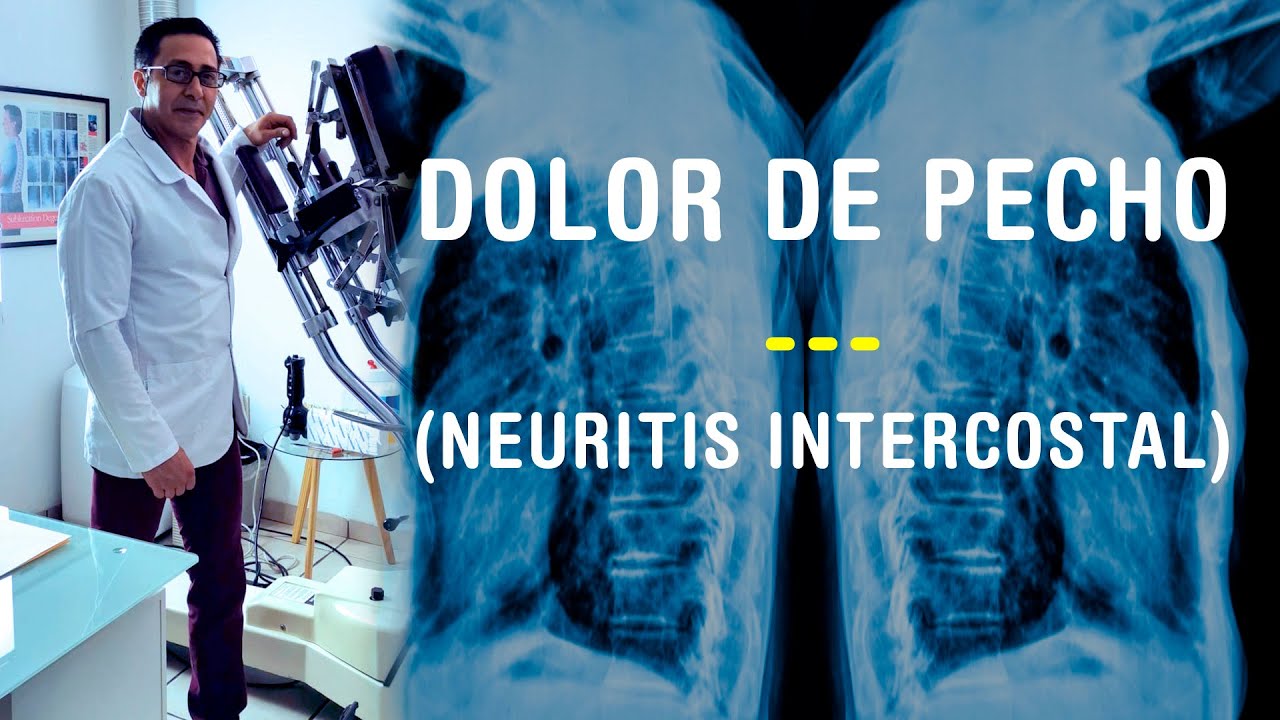 remedios naturales para la neuritis intercostal