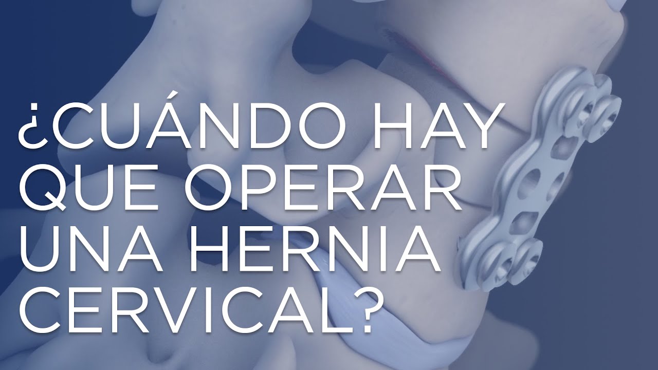 riesgos de operacion hernia cervical c6 c7