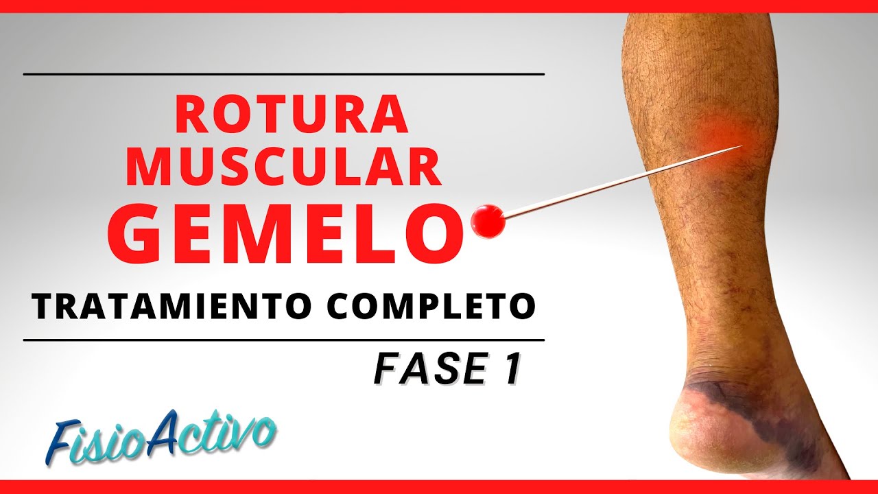 se puede andar con rotura de fibras en el gemelo