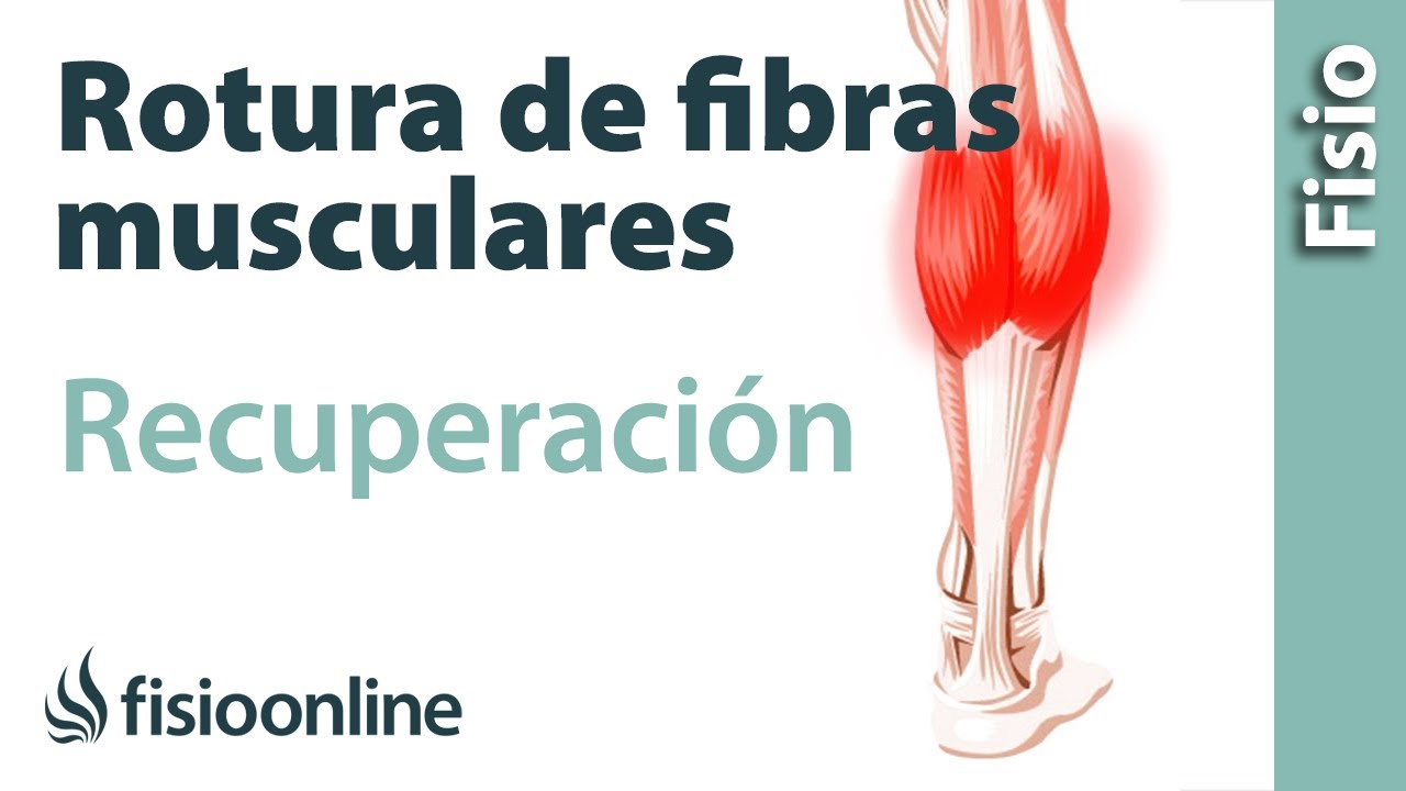 se puede andar con una rotura fibrilar