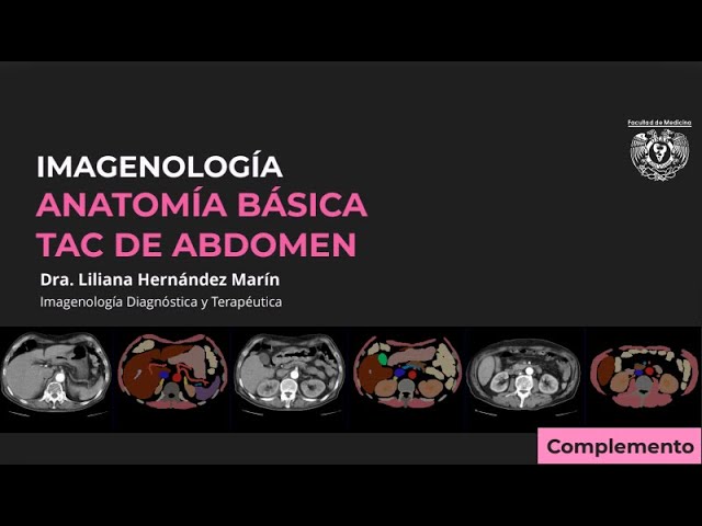 tac abdominal que organos se ven