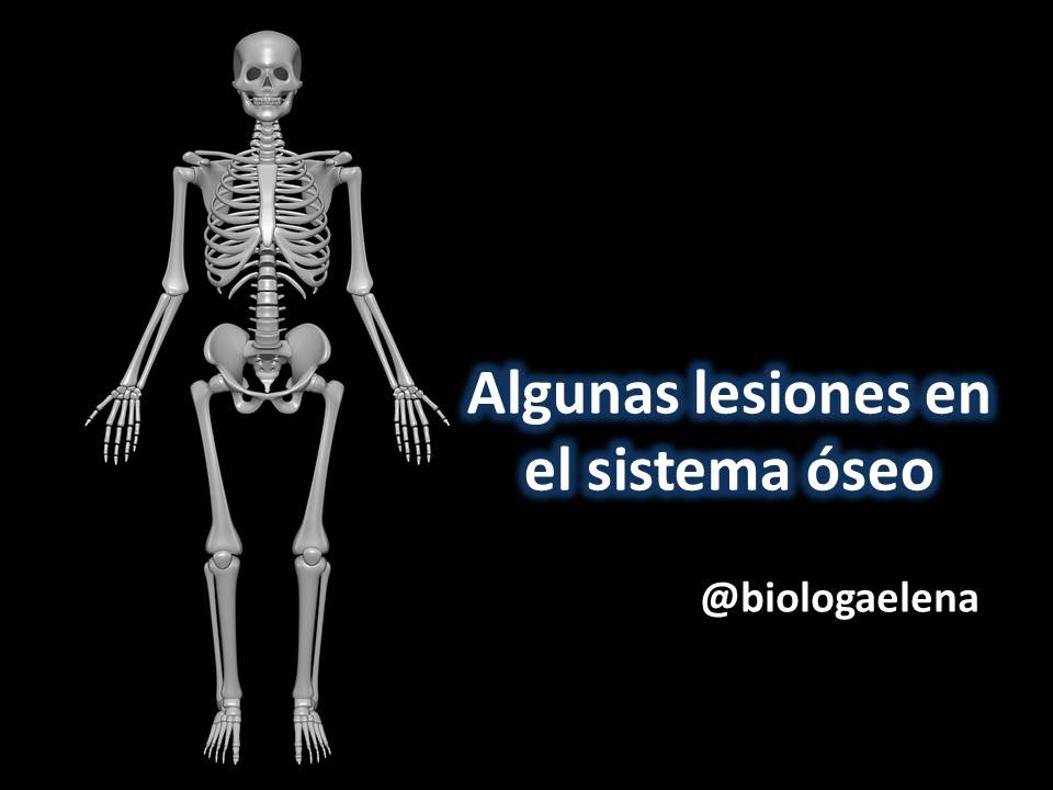 tipos de lesiones en los huesos