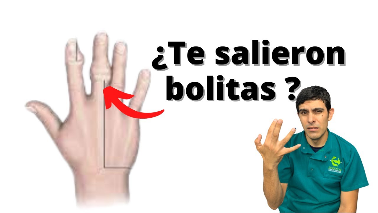 bolita en el dedo indice dela mano