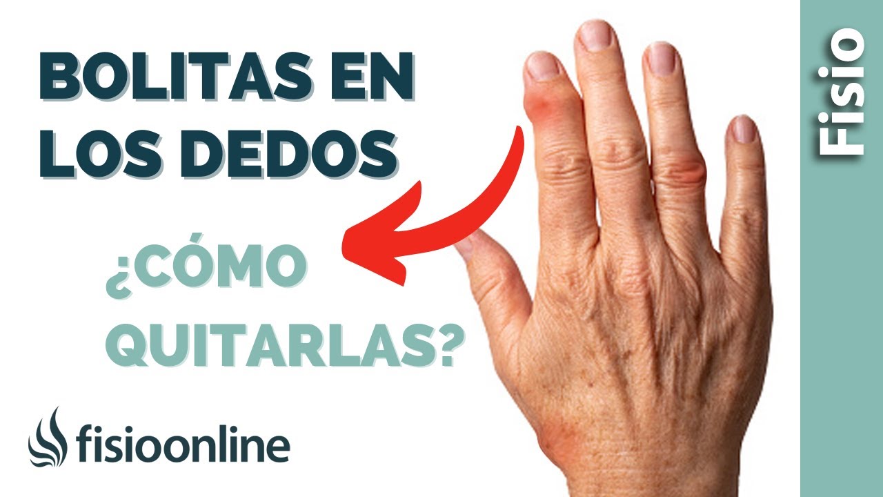 bultos en las articulaciones de los dedos