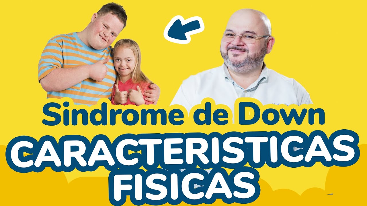 caracteristicas de las personas con sindrome de down