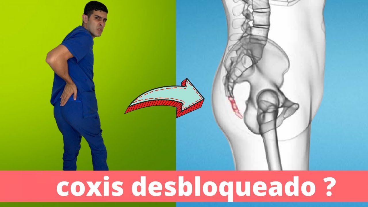 como colocar el coxis en su lugar