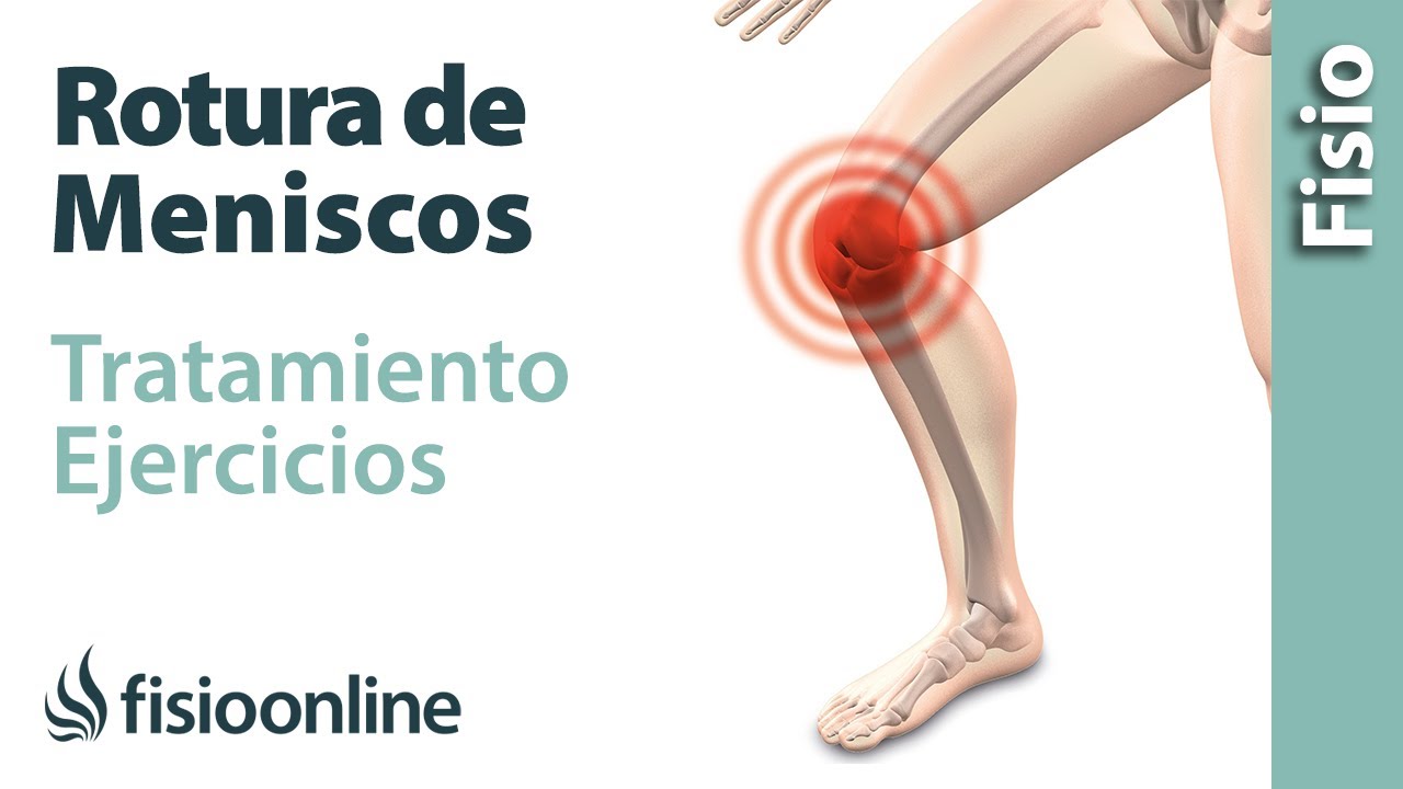 como curar un menisco roto de la rodilla