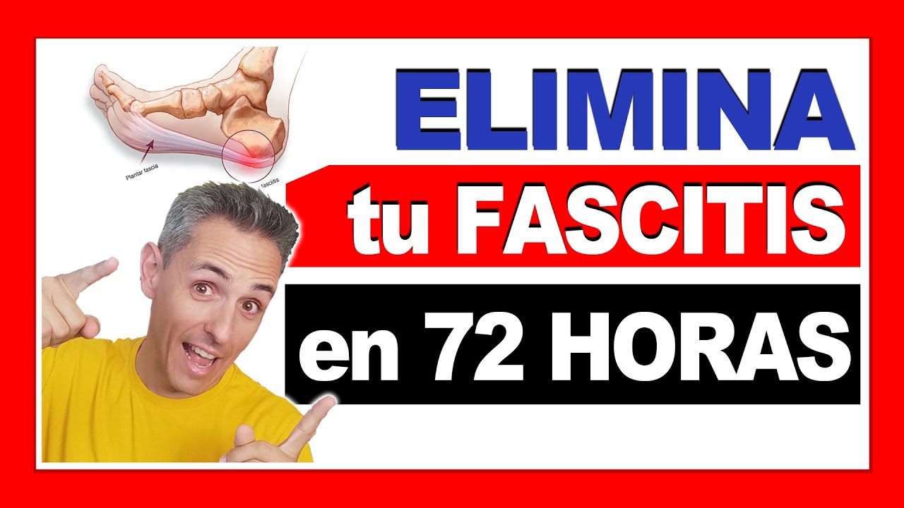 como eliminar fascitis plantar en solo 72 horas