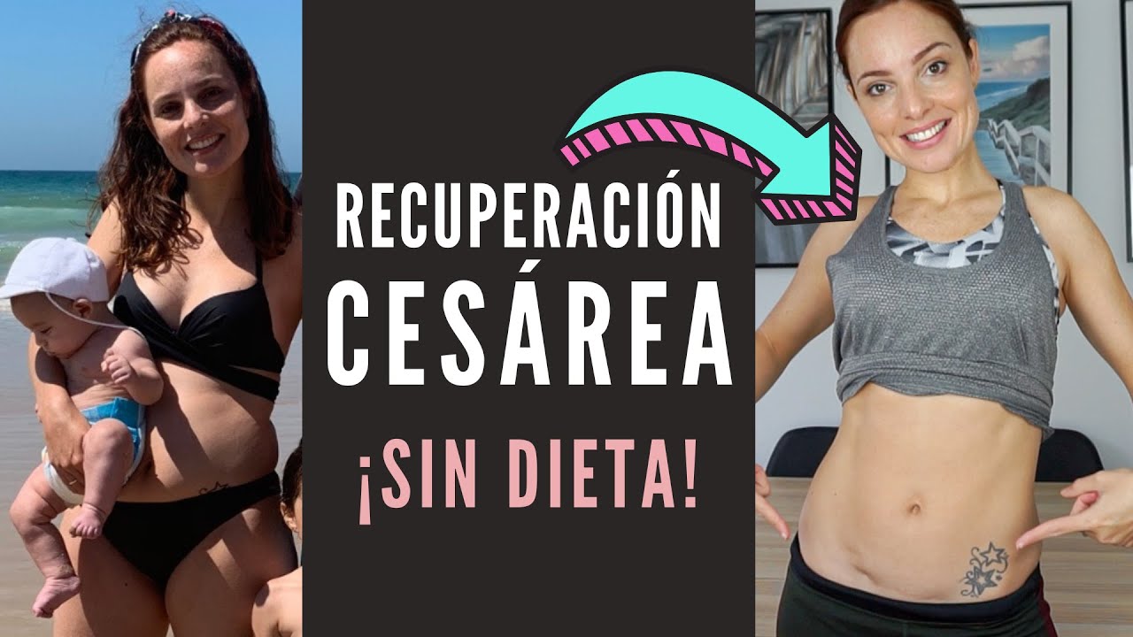 como recuperar la barriga despues de una cesarea