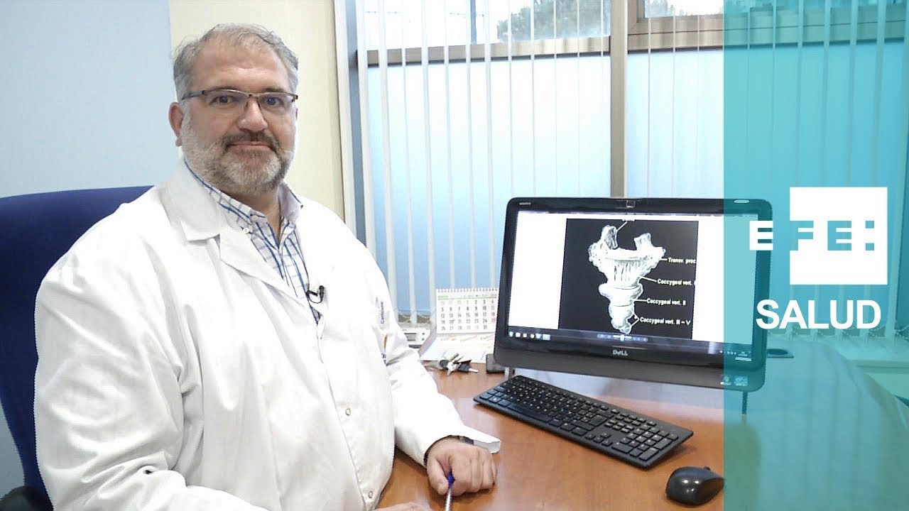 como saber si tengo el coxis fracturado