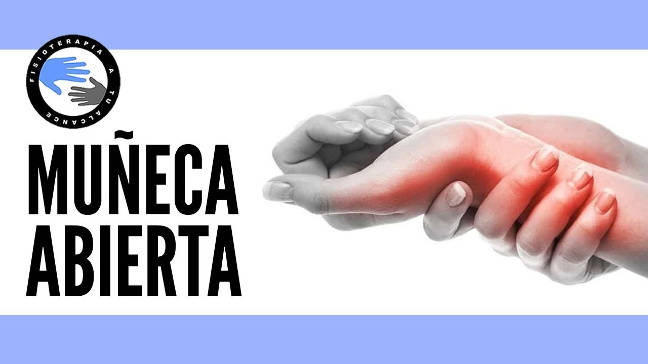 como saber si tengo la muñeca abierta
