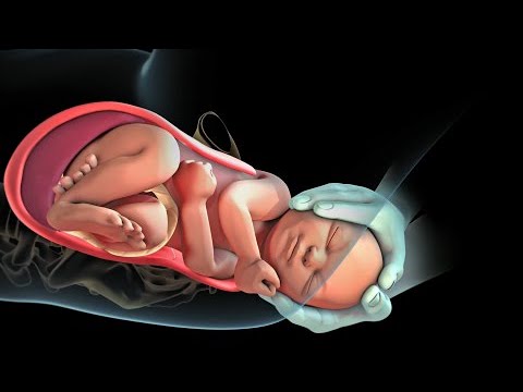 como se abren los huesos en el parto