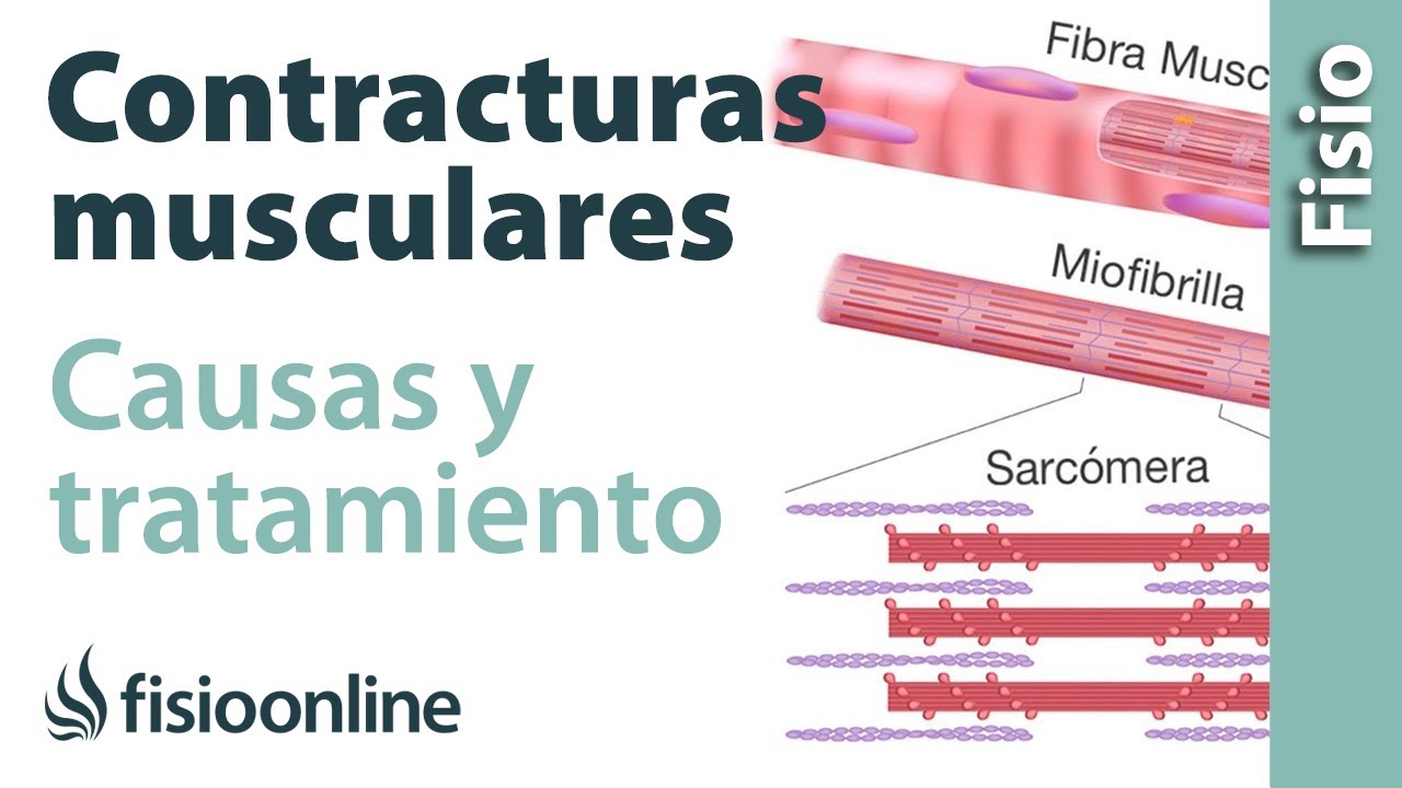 como tratar una contractura en el muslo
