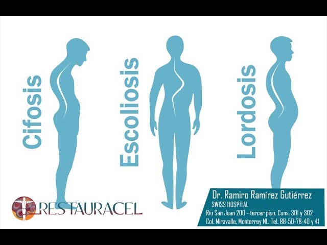 cuales son las curvaturas anormales de la columna vertebral
