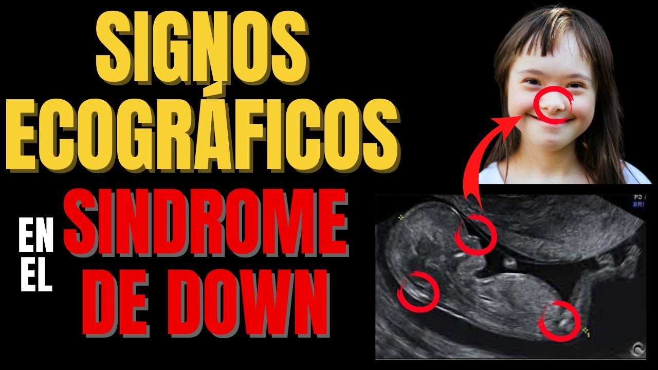 cuando se forma la nariz del feto