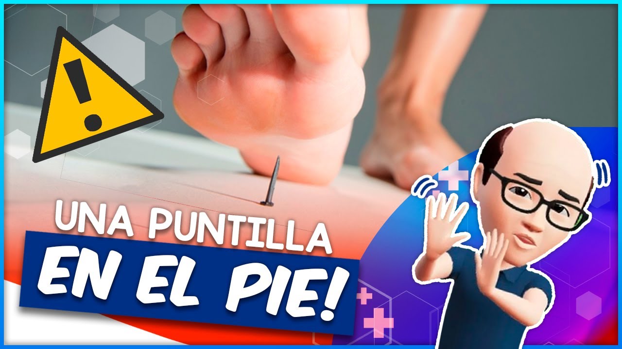 dolor de clavo en el pie