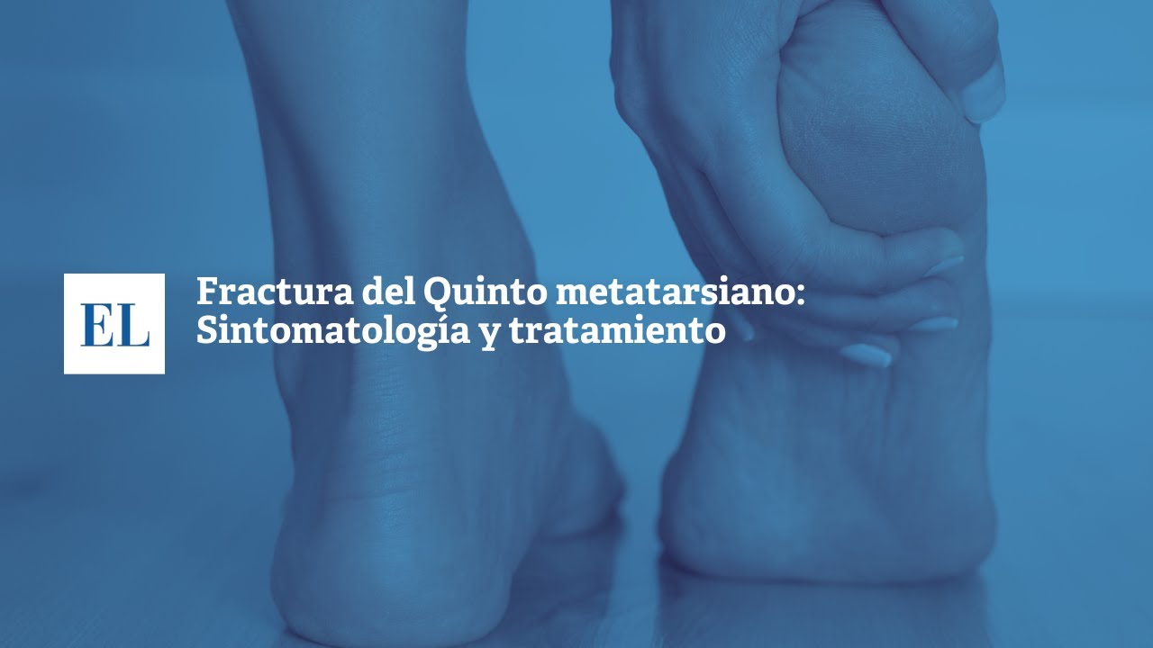 dolor despues de fractura del quinto metatarsiano