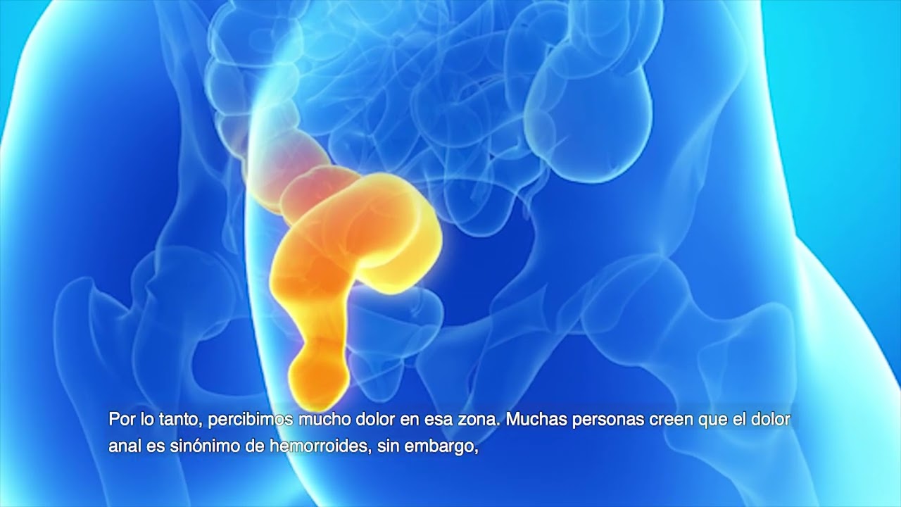 dolor en el ano al estar sentado