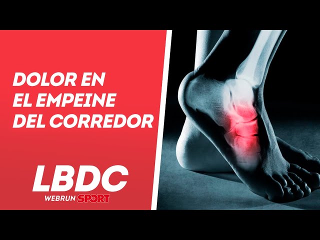 dolor en el empeine del pie por correr